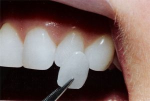 Dental Articles/Education