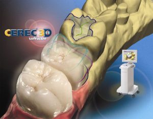 E4D CAD Cam Dentistry
